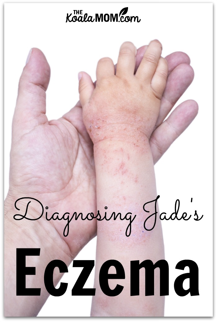 Diagnosing Jade's eczema (parent holding a toddler's hand)