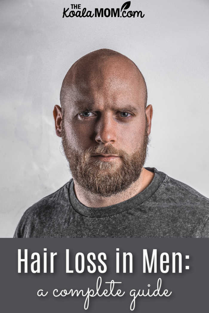 Hair Loss in Men: a complete guide. Photo by Zoran Borojevic on Unsplash