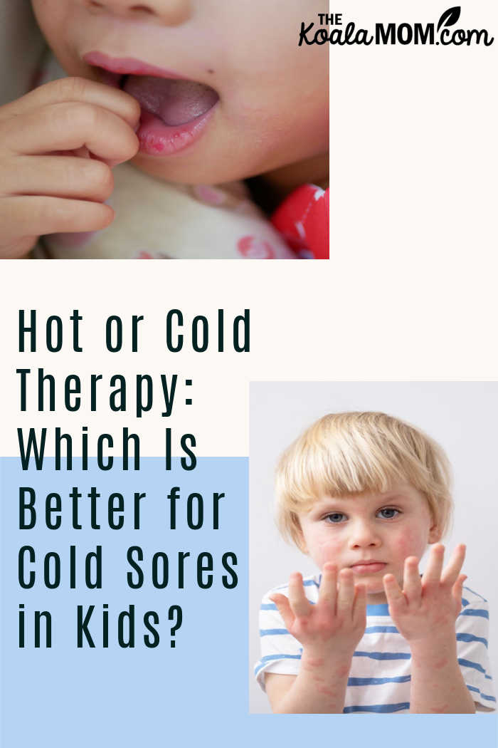 Hot or Cold Therapy: Which Is Better for Cold Sores in Kids?