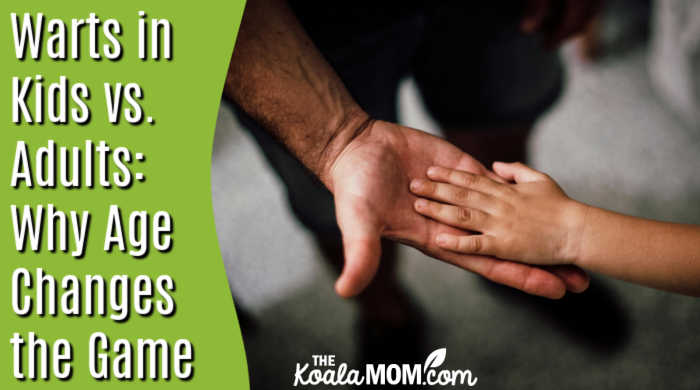 Warts in Kids vs. Adults: Why Age Changes the Game. Photo of child's hand in adult's hand by Juan Pablo Serrano via Pexels.