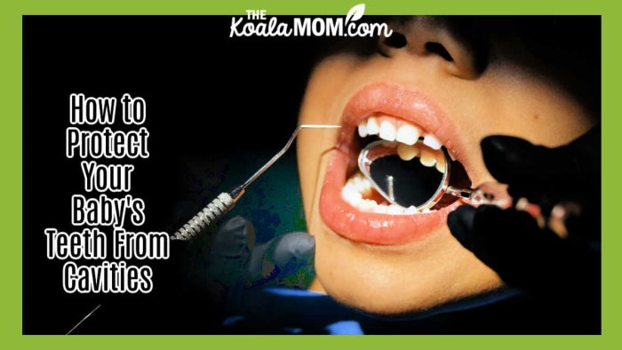 How to Protect Your Baby's Teeth From Cavities. Photo of dentist checking young boy's teeth by cottonbro studio via Pexels.